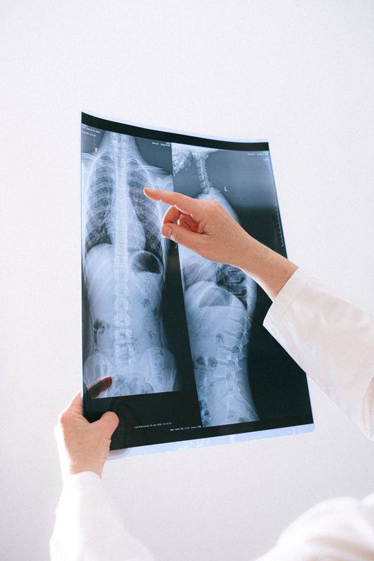 Médica revisando una radiografía de columna